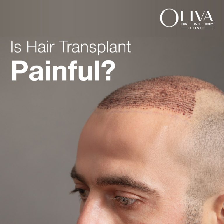 is hair transplant painful