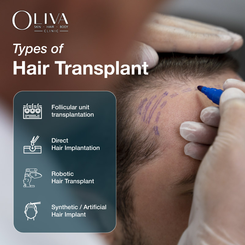 Types of Hair Transplant Techniques | FUE, DHI, FUT Explained