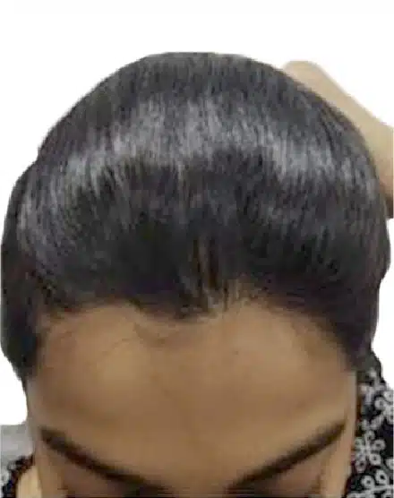 After