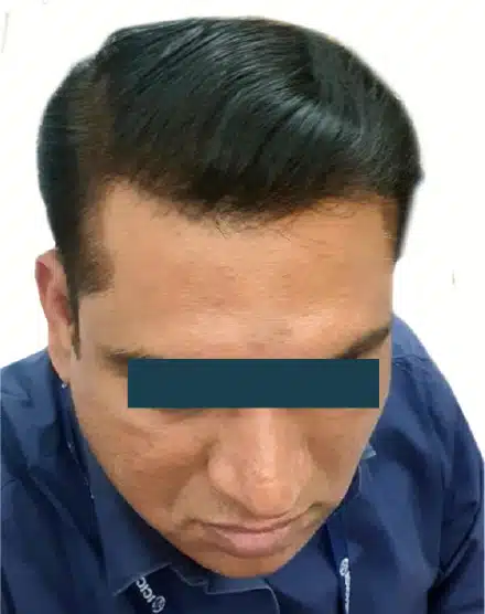 After