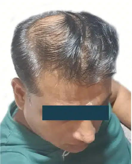 Before
