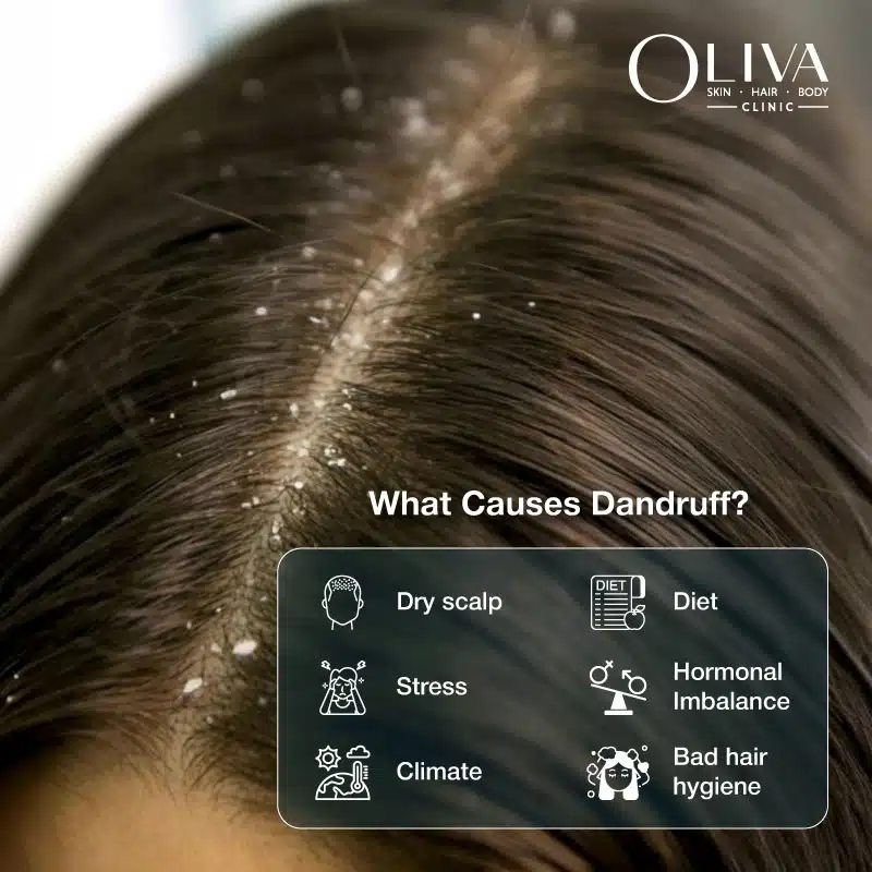 Dandruff Causes: Top Triggers, Symptoms & How to Stop It Naturally