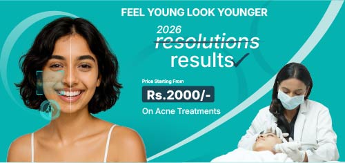 acne offer cost section