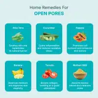 home remedies for open pores