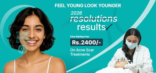 scar offer cost section