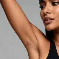 what causes dark under arms
